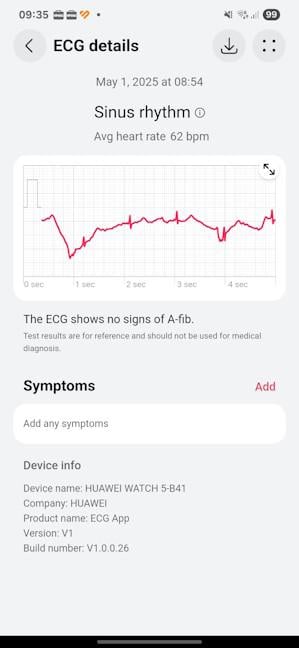 HUAWEI WATCH 5 este certificat ca dispozitiv medical pentru citiri ECG