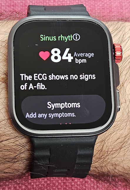 Este uÈor sÄ efectuezi o înregistrare ECG