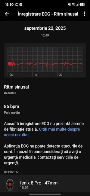 FuncÈionalitatea EKG merge Èi în România