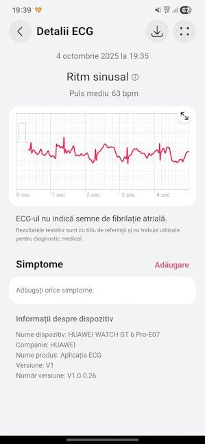 PoÈi avea o electrocardiogramÄ Ã®n 30 de secunde