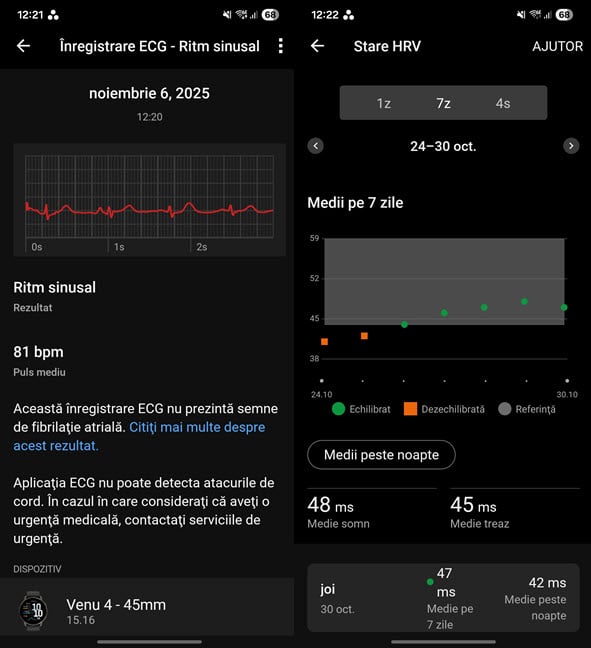 ECG-ul merge &Egrave;i &Atilde;&reg;n Rom&Atilde;&cent;nia