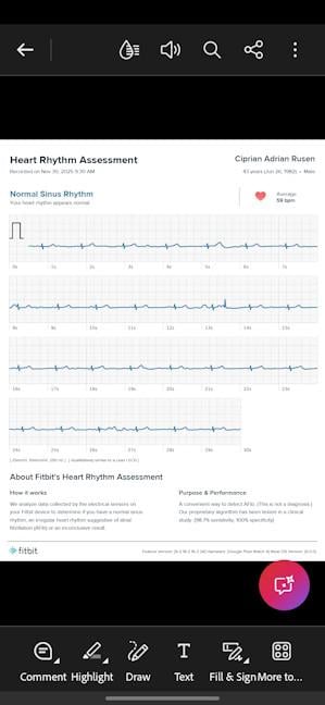 Po&Egrave;i face EKG-uri pe Google Pixel Watch 4