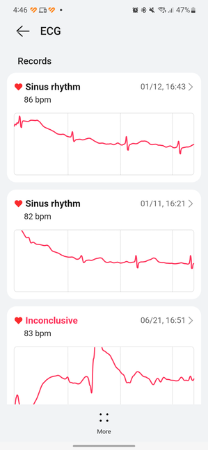 Ai nevoie de un istoric al EKG-urilor tale?